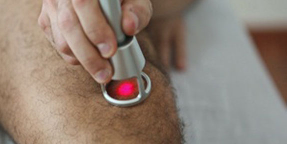 Cold Laser Therapy San Francisco